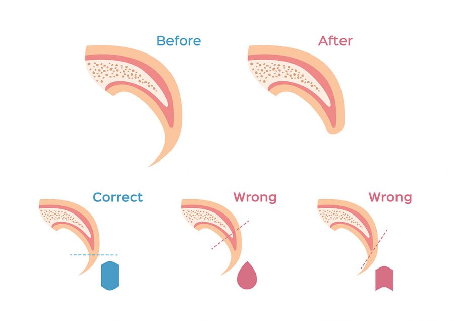 1 How to trim your dog's nail